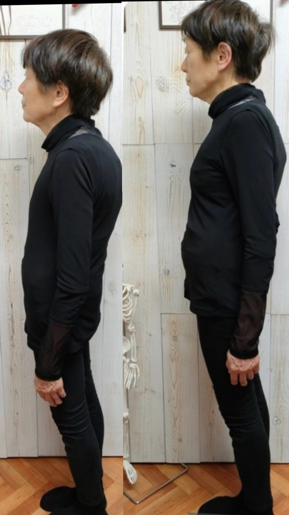 Side view of a woman, photographed before (left) and after (right) a Yurutoto session.